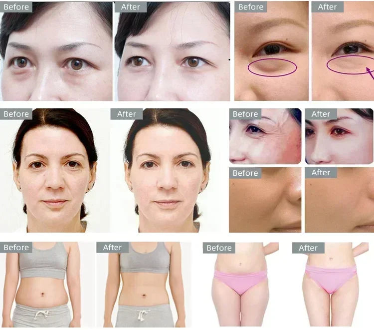 Body Slimming 40K Cavitation Ultrasonic Weight Loss Skin Rejuvenation Beauty Machine Multipolar  Skin Tighten Anti-wrinkle