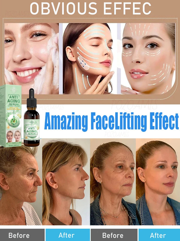 wrinkles disappeared